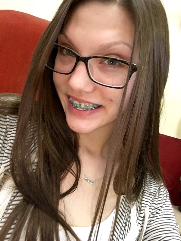 Fundraiser By Sasha Meow Help Me Pay For My Braces Please 1648
