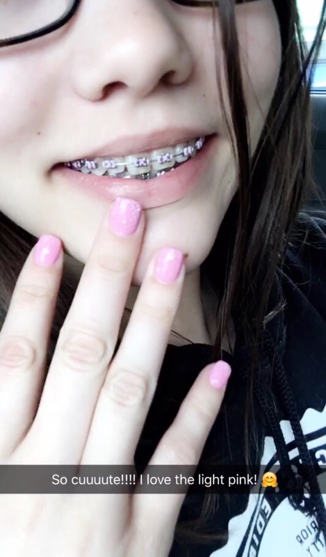 Fundraiser By Sasha Meow Help Me Pay For My Braces Please 